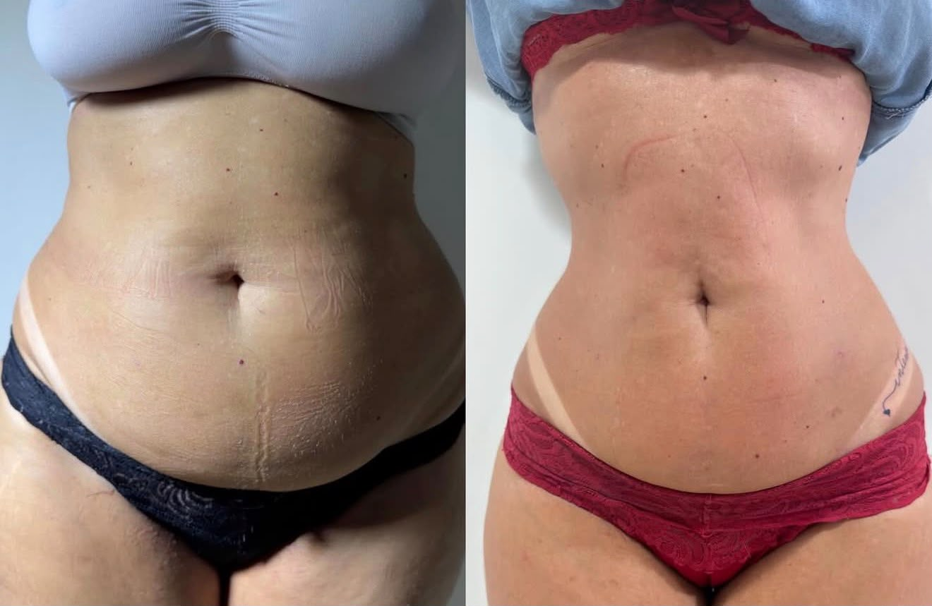 Client transformation 2