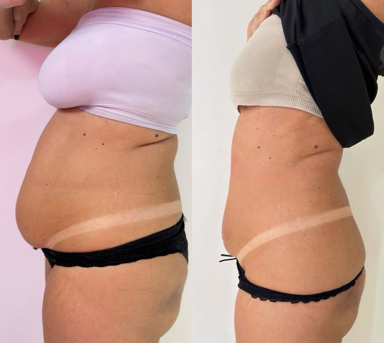 Client transformation 1