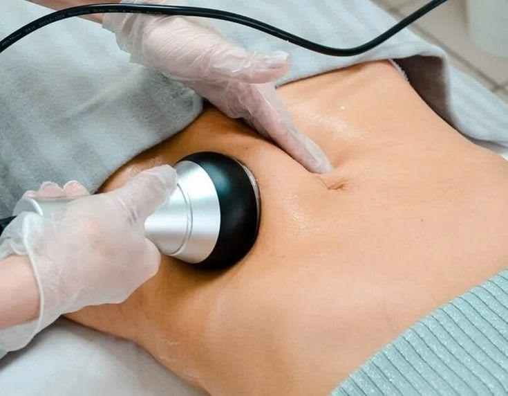 Ultrasound Cavitation