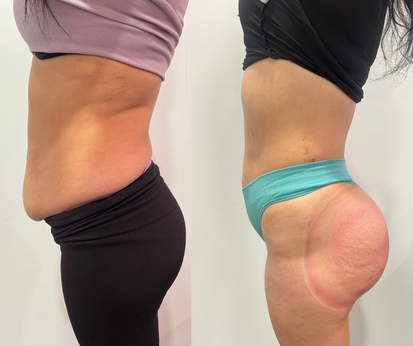 Client transformation 4