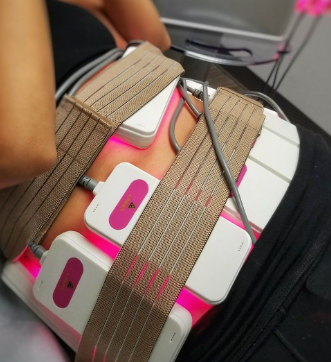 Laser Lipo
