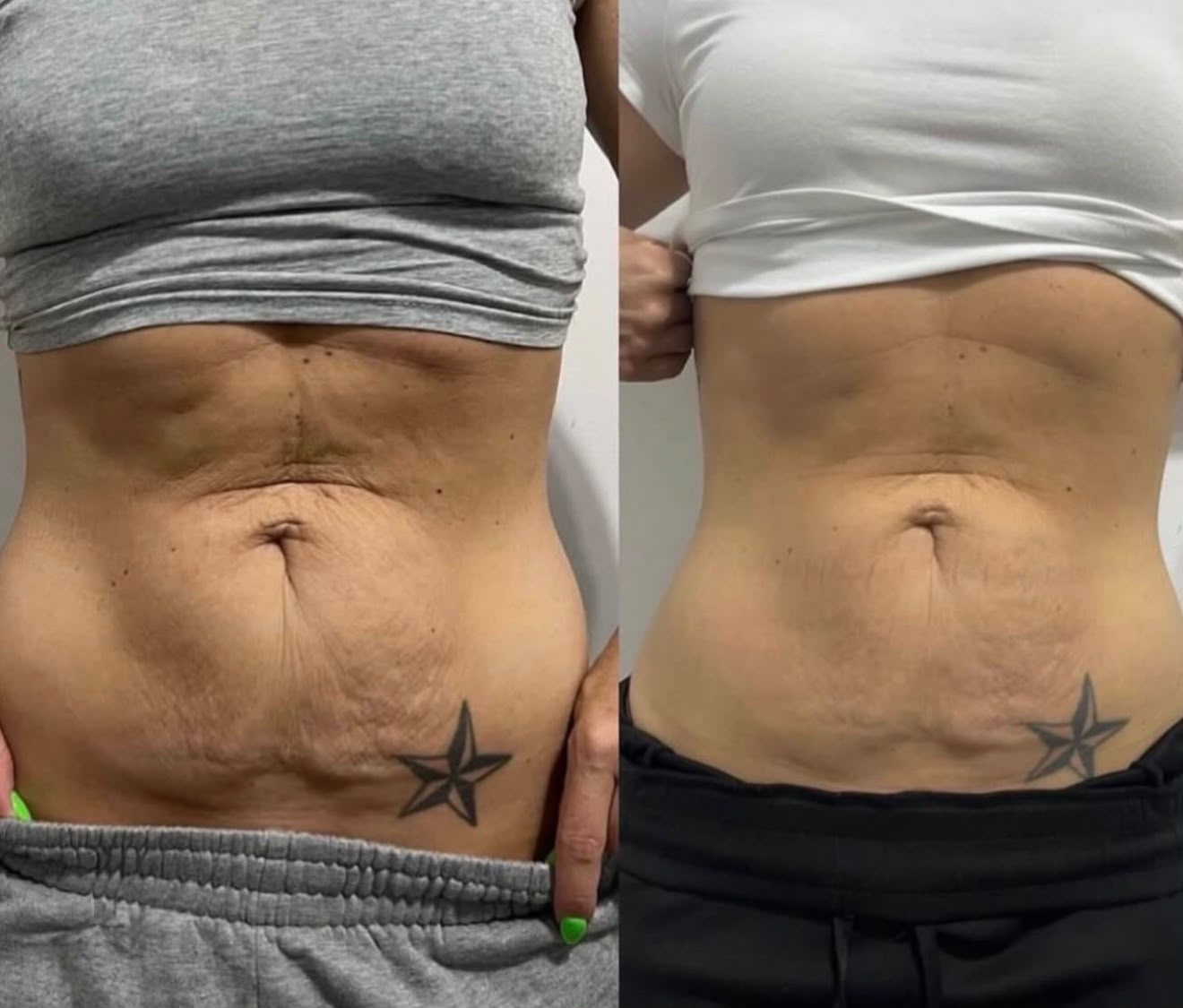 Client transformation 6